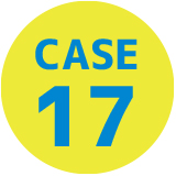 CASE17